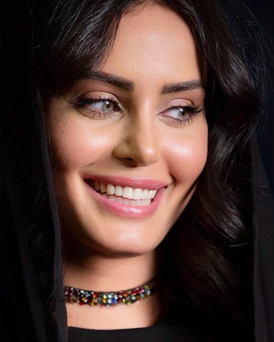 الناز (1)