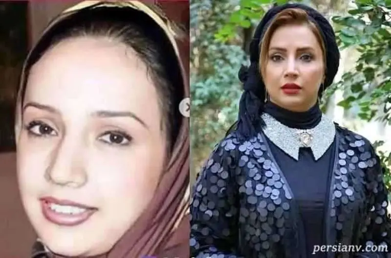 بازیگرانی که زیباتر شدند